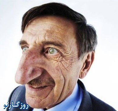 بزرگترین بینی جهان