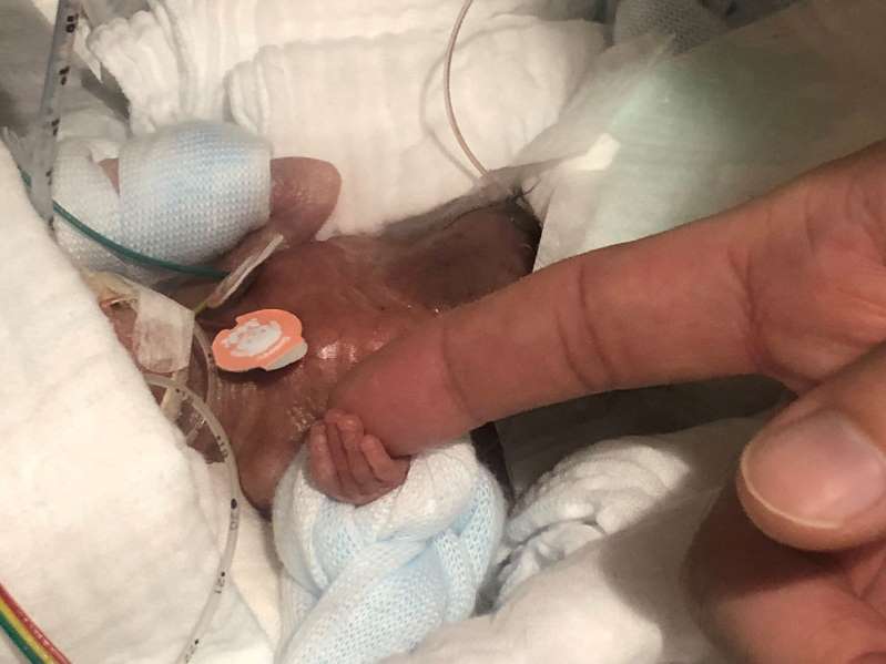 کوچکترین نوزاد پسر، سالم از بیمارستان مرخص شد