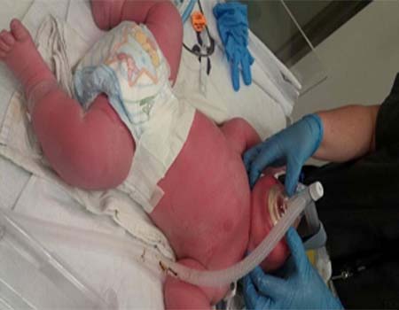 تولد نوزاد هفت کیلویی در نیوزیلند