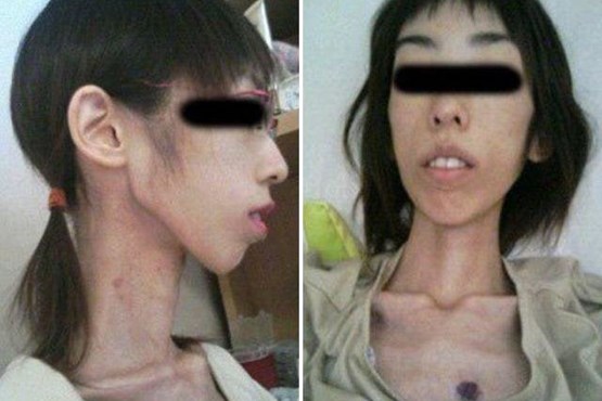 شکنجه دختر ژاپنی با کاهش وزن! +عکس