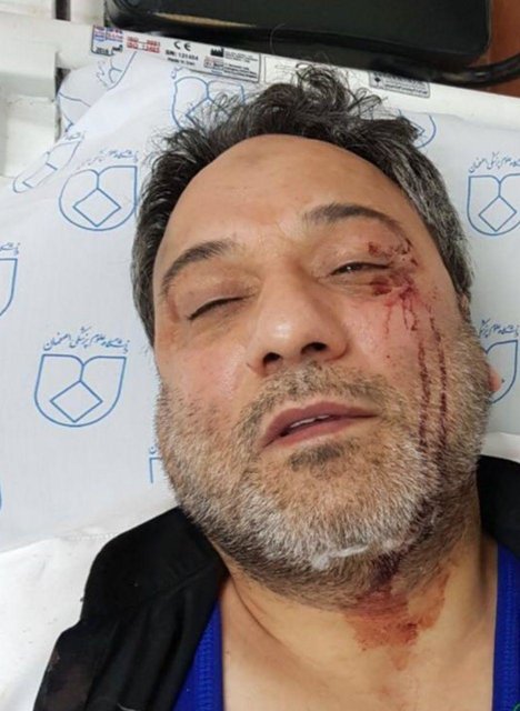 جزئیات حادثه ضرب و شتم کادر درمانی بیمارستان فارابی اصفهان
