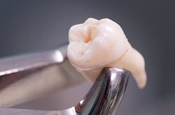 «جویدن» با دندان‌های ما چه می‌کند؟