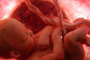 عواملی که خطر سقط جنین را افزایش می‌دهند