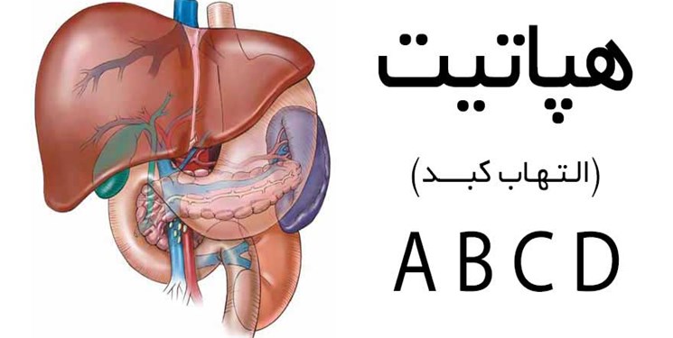 «هپاتیت» بیماری خاموش/ بی‌اطلاعی ۸۵ درصد بیماران از هپاتیت