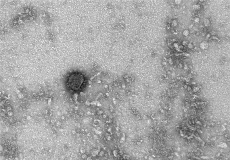 جدیدترین تصاویر از ویروس کرونا پس از کشف دانشمندان روسی