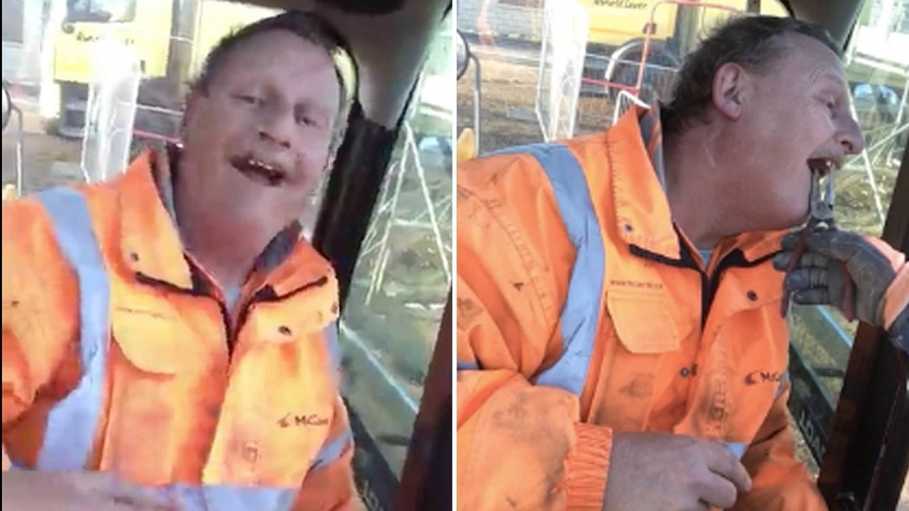 کارگری که فقط با انبردست دندان هایش را می‌کشد!+عکس