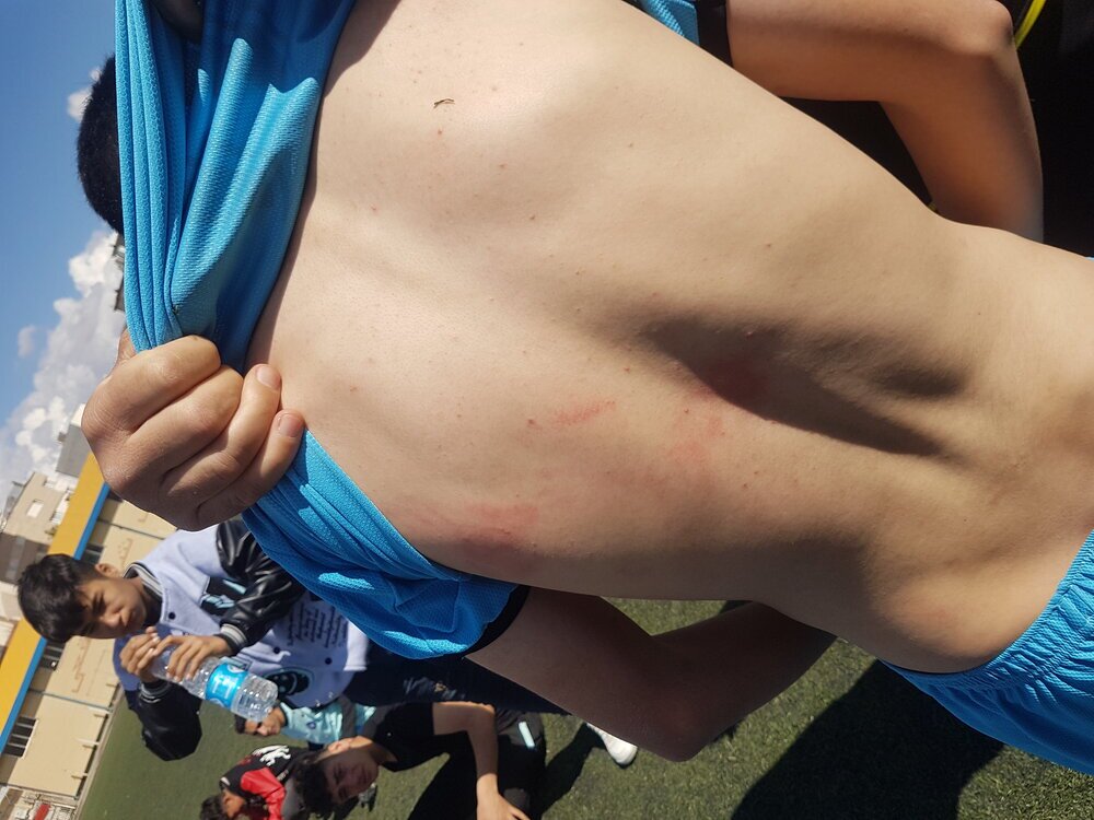 درگیری در لیگ نونهالان